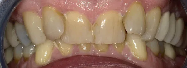 Before image