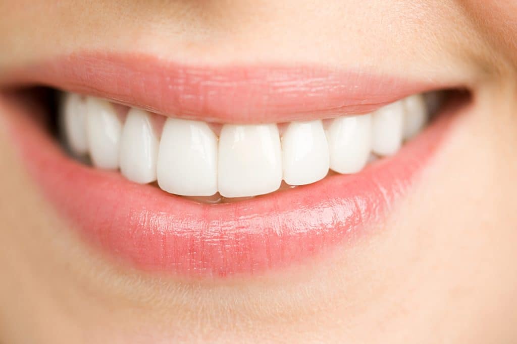 3 Options for Whitening Your Teeth